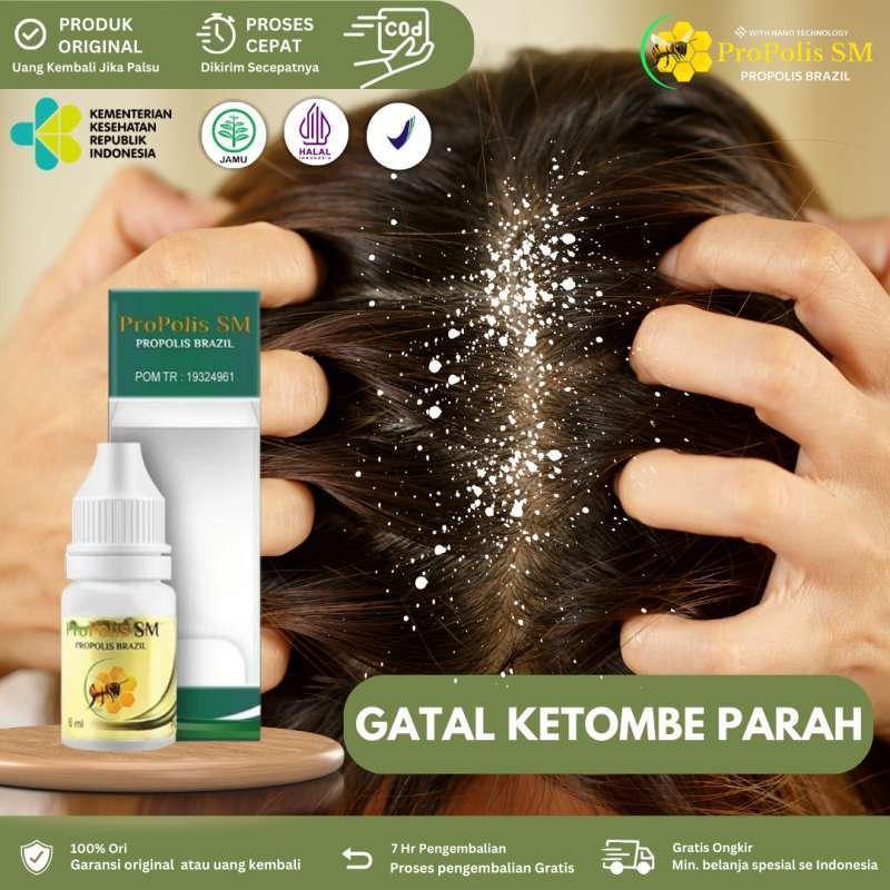 Agen Anti Rontok Rambut Terpercaya di Indonesia